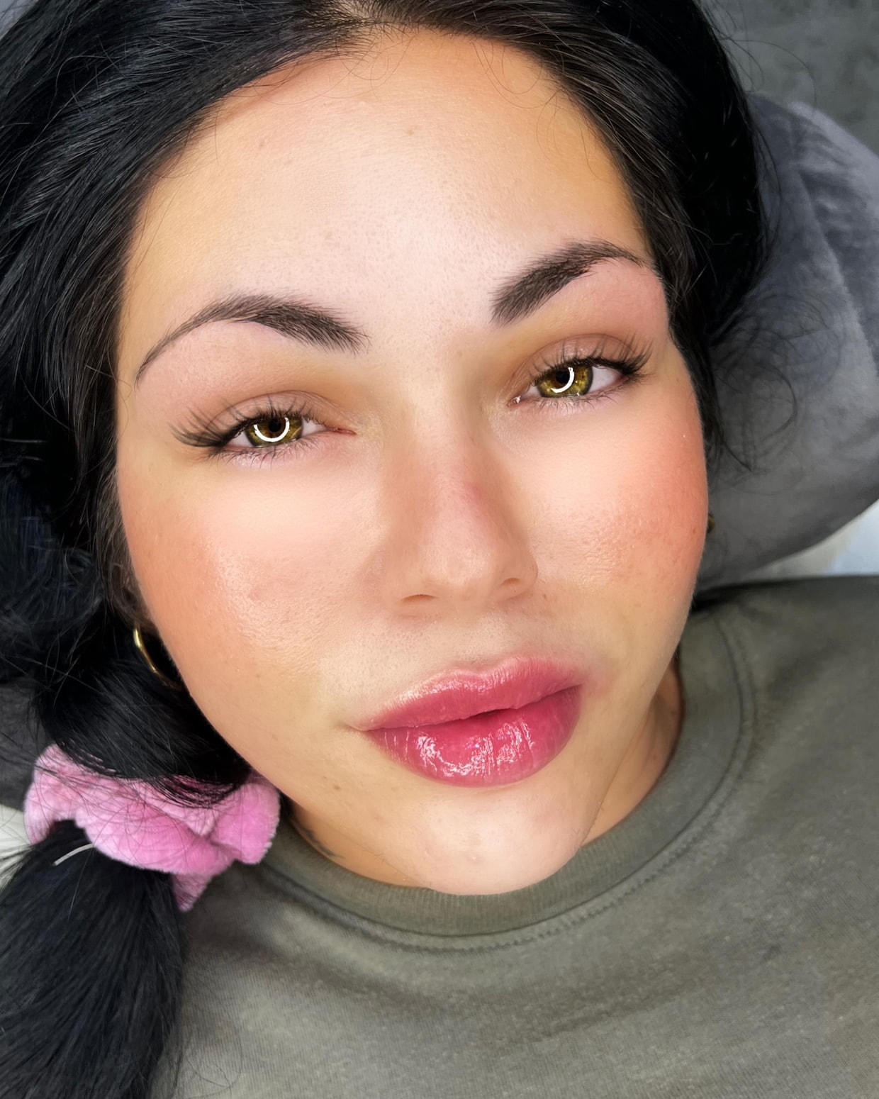 A client after treatment