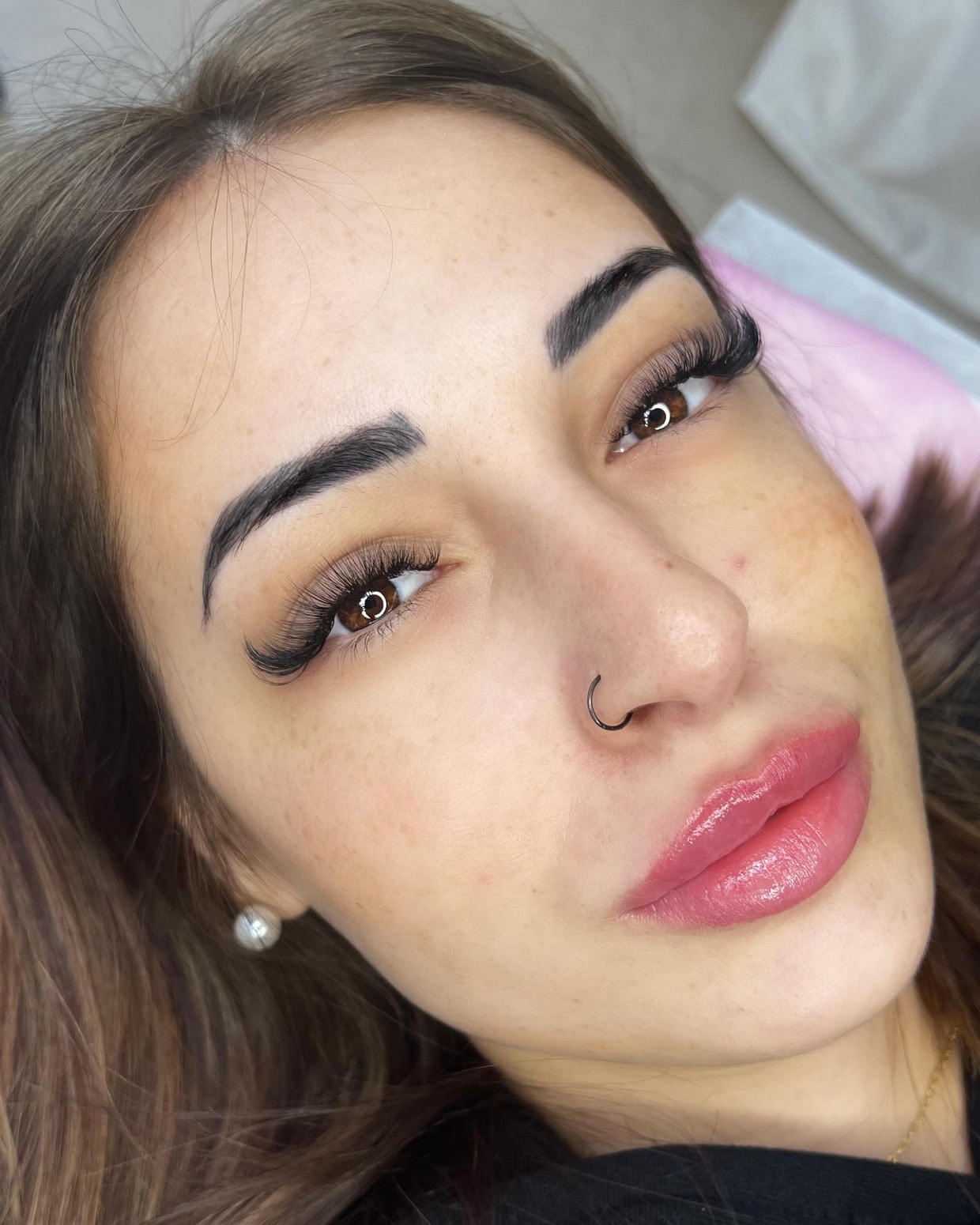A client after treatment